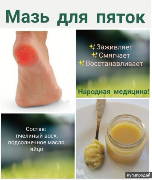 Мазь для Пяток, от трещин на пятках, стопах в Тюмени